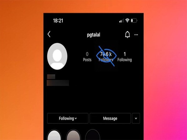 Vì sao nên ẩn follows trên Instagram?
